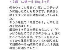 ピアリーノ(Pialino)/