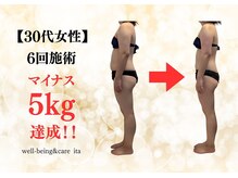 イタ 岡崎店(ita)/【　ビフォーアフター　】