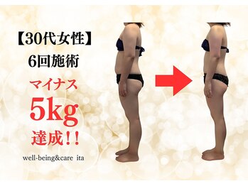 イタ 岡崎店(ita)/【　ビフォーアフター　】