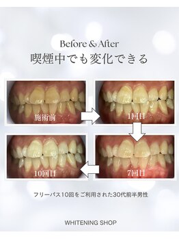 ホワイトニングショップ 南堀江店/セルフホワイトニング[南堀江]