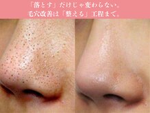 モアビューティー 楽々園店(MORE BEAUTY)