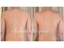 サロン ド ソワ(Salon de Soie)/ハイパーナイフ×ハンド 4回