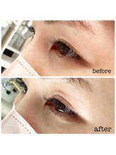 ヴィヴィアンジュ(viviange)/ラッシュリフト(下のみ)