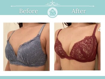 美人バスト 岡崎店/【バストアップ・育乳】症例☆