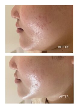 エモベーシック(e'MO BASIC)/