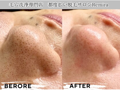 レミーラ(Remira)の写真