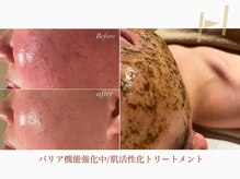 ハレル ビューティーサロン(Hareru beauty salon)の雰囲気（揺らぎやすいお肌を卒業！６種類の肌活性トリートメントサロン）