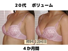バストサロン メルベイユ(Merveile)/ボリューム、立体感UP　C→Eに！
