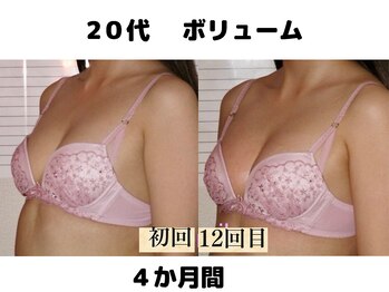バストサロン メルベイユ(Merveile)/ボリューム、立体感UP　C→Eに！