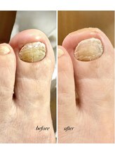 ラヴィ(La vie)/爪が伸びやすくケア