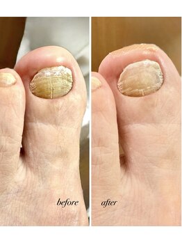 ラヴィ(La vie)/爪が伸びやすくケア