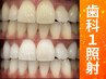 【会員／回数券】20分×1回歯科提携セルフホワイトニング
