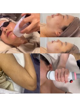 小顔になりたい