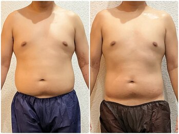 ウェリナ平和堂長久手院/小顔矯正/骨盤矯正/美脚サロン