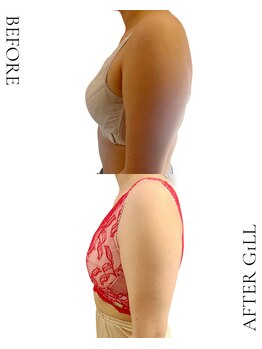 ビジュアルラボ(VISUAL LABO)/