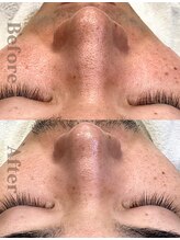 ディレイア ザ コスメ 有楽町マルイ店(direia the cosme)&nbsp;40代 (男性)