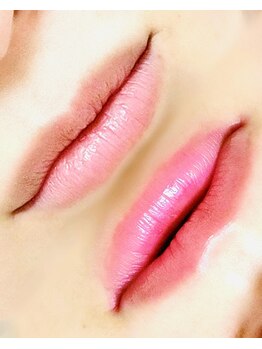 ビューティーツリー(Beauty Tree)/シミ・毛穴一気に改善^^