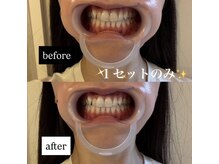 スールボーテ(soeur beaute)