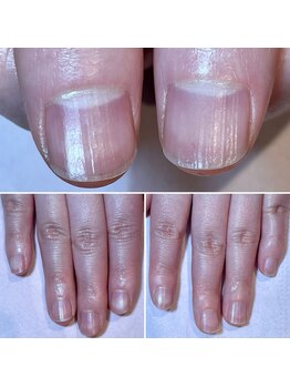 ココデネイル(cocode nail)/お悩み:爪の形が…(30代後半)