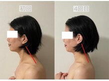 ステムサロン(stem salon)/ビフォーアフター