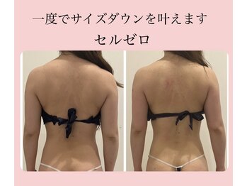 ビューティー アディクト(Beauty addict)/一度で結果出し♪