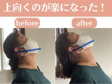 サッカ(札佳 sakka)/首の詰まりも楽になります！
