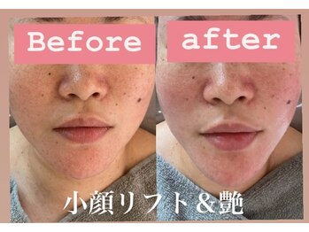 ティパニボーテ(Tipani Beaute')/小顔