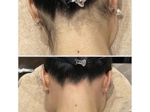 セレーノ(Sereno)の雰囲気（【丁寧な施術】大人気！うなじWAX脱毛ですらりとした後ろ姿に★）