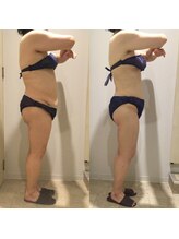 アユアランリンク 札幌中島公園店/E様：側面