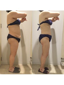 アユアランリンク 札幌中島公園店/E様：側面