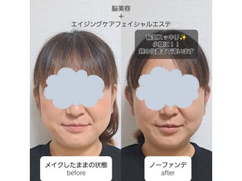 ネマウム(nemaum)/脳美容＋フェイシャルエステ