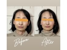 ブリリアント 西宮(Brilliant)/