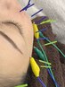 ＜セットクーポン＞リフトアップ電気美容鍼50分＋クイック鍼灸30分 ¥10500