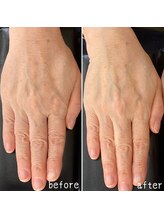 ネイルズ アヴァンティ(Nails Avanti)/ネイルケア&ハンドケア