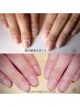 ※学割U24※女性性専用※ 深爪矯正（人工爪長さ出しなし）￥13200円→￥9800