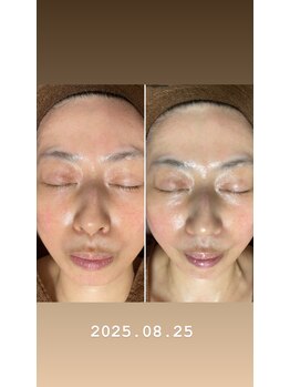 コルッソ(CoLusson.)/ホワイトスノーピール