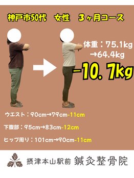 摂津本山駅前鍼灸整骨院/50代女性