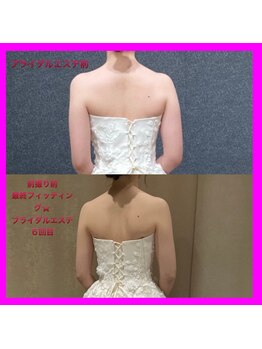 ディア スプリーマ/ブライダルエステ★予約殺到！！