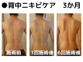 ビープラス(Biplus)/肌質改善は顔だけじゃない！