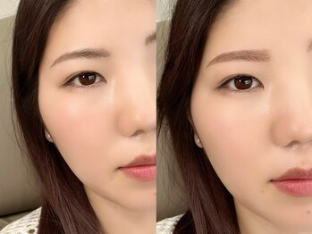 チルアンドアイ 千葉駅前店(Chill&Eye)/美眉スタイリング/BeforeAfter