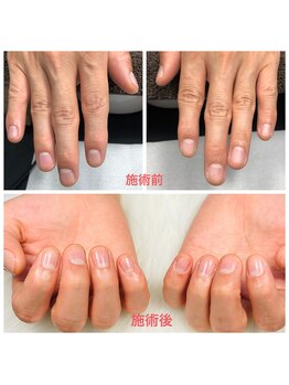 スペシャルハンドケア