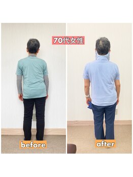 長岡痛み専門整体院みらい 長町店/Before&After