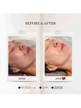 エクラ アン(eclat.un)/50代女性：ララピール