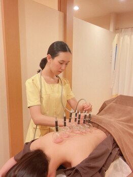 鍼灸治療院エール(YELL)/カッピング