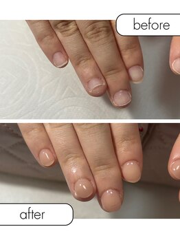 ピノ(pino)/◆深爪矯正＋自爪風仕上げ◆