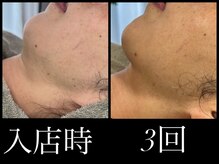 ビーエルティー(blt)/レモンボトル