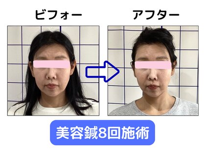 岡町おうち鍼灸整骨院の写真