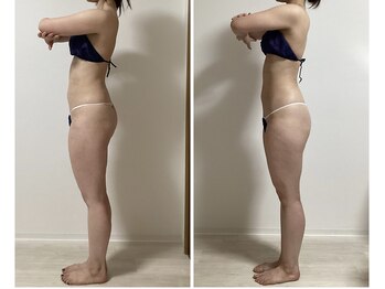 カリス/半身5回☆1ヶ月~2ヶ月に1回施術