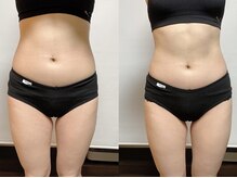 ザ ボディメイク(THE BODY MAKE)/ウルトラ痩身×2