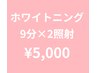 【メンテナンスホワイトニング】9分×2照射◎イベントごとなどの前におすすめ